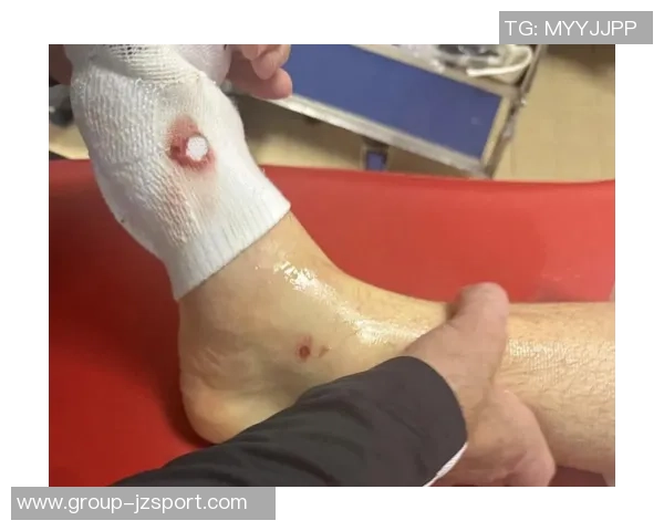 法国裁判总监承认卡马拉飞铲舍瓦利耶误判应该出红牌